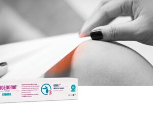 Rigenoma crema 100 ml